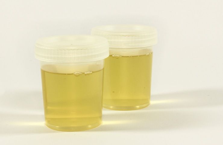 contenitori urina