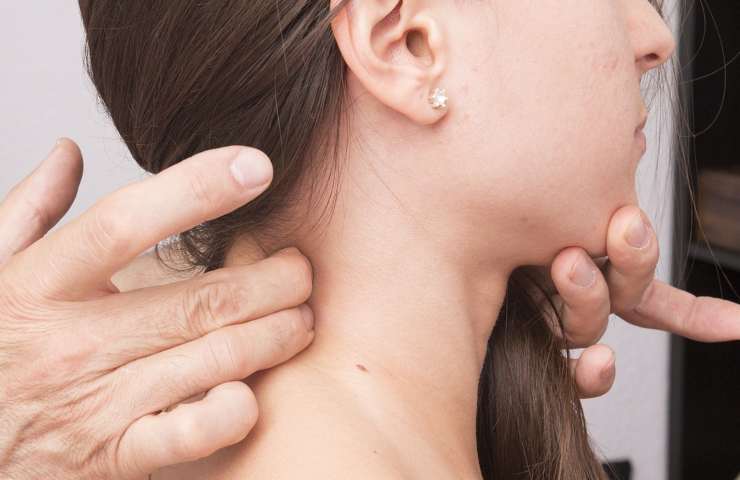 Cervicale infiammata rimedi naturali