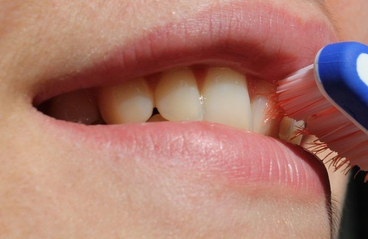 pulizia denti: quando effettuarla?