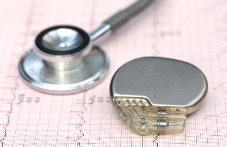 problemi cardiaci pacemaker novità 