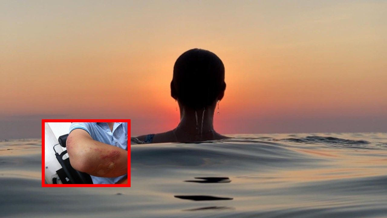 pericolo ferite acqua