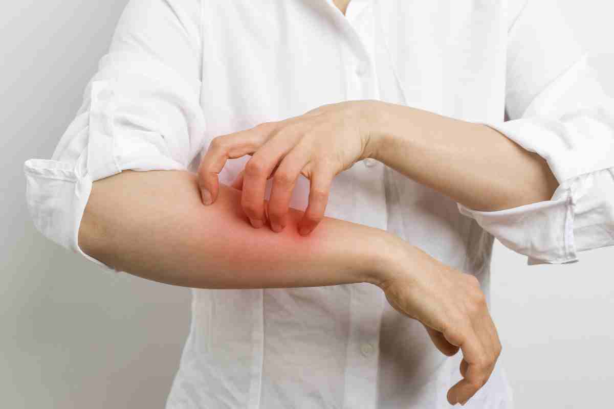 Legna tossica e allergie: le malattie che non conosci